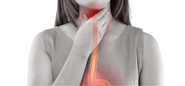How to Treat a Sore Throat